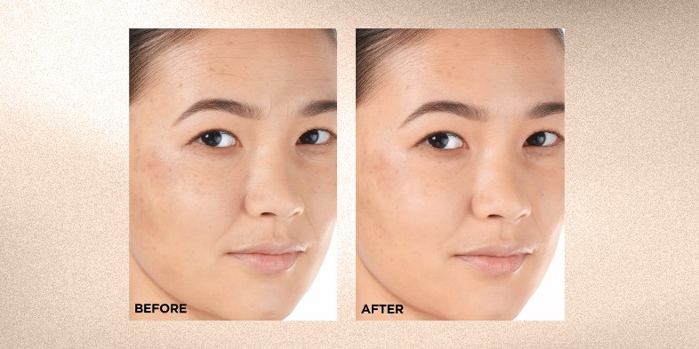 InArticlewhatisavitamincconcentrateRevitaLift 12 Pure Vitamin C E Salicylic Acid Serum